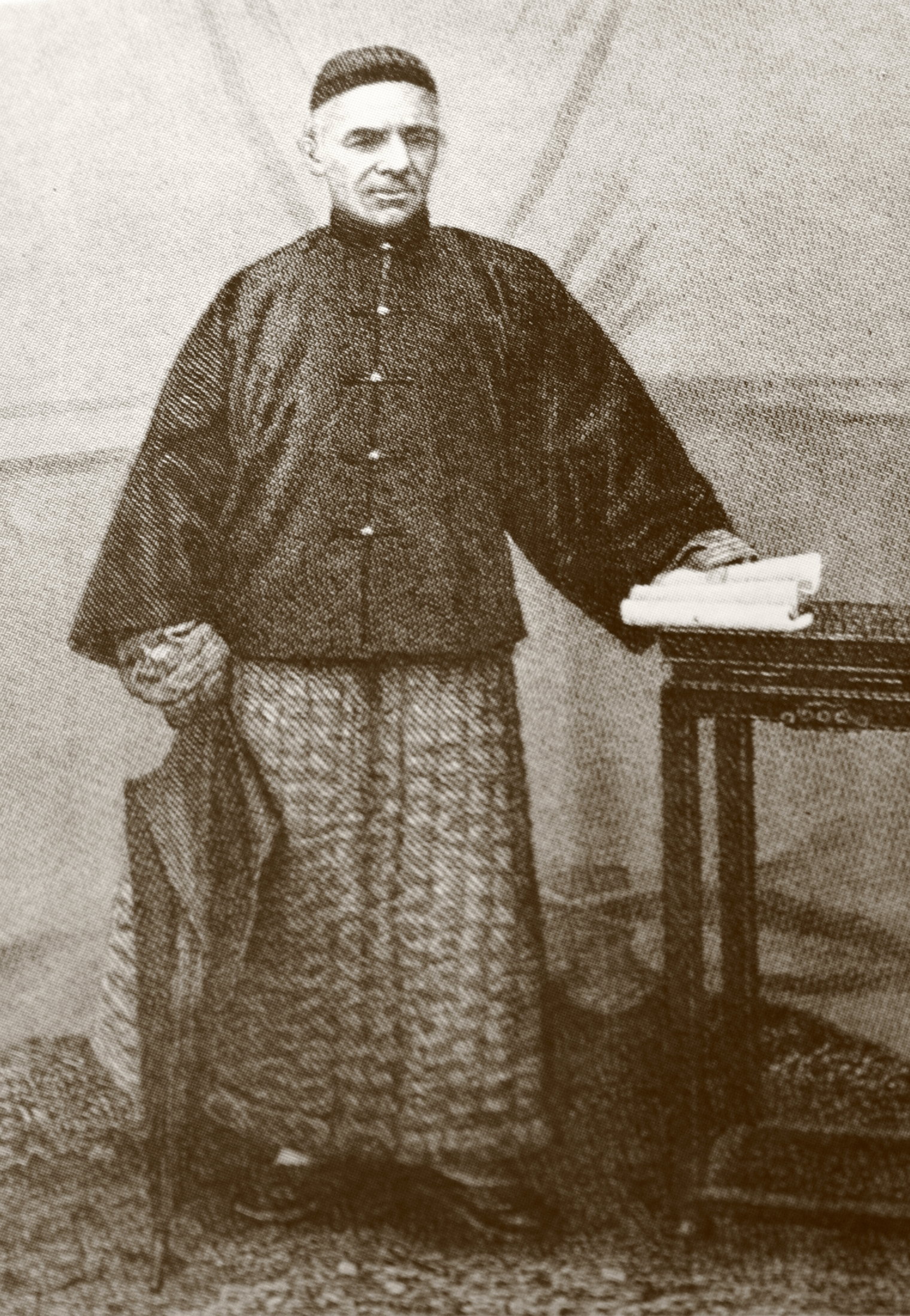 Burns in Chinese Dress